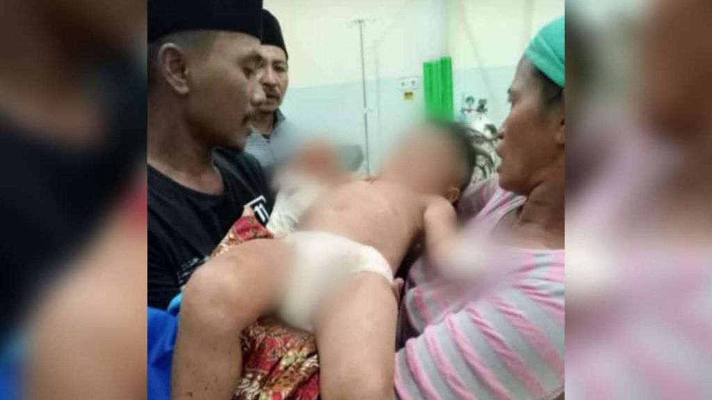 Tangan Bocah Sokobanah Terpotong Mesin Rajang Tembakau