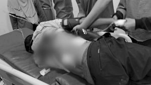 Didor OTK, Tokoh Sampang Alami Dua Luka Tembak