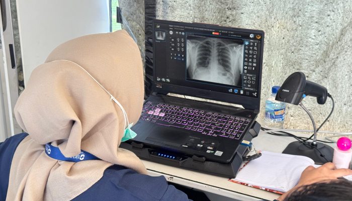 Lapas Narkotika Pamekasan Laksanakan Deteksi Dini Tuberkulosis